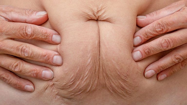 Scientists Discover Early “Big Bang” Event That Determines Bowel Cancer Trajectory