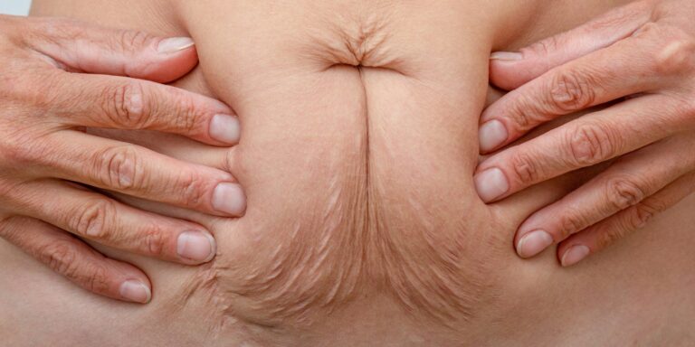 Scientists Discover Early “Big Bang” Event That Determines Bowel Cancer Trajectory